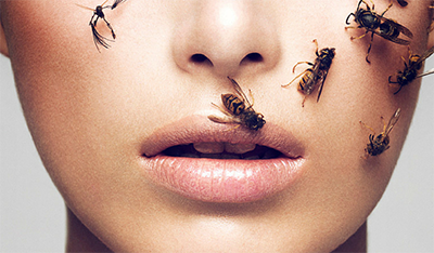 Veneno de abeja, ¿la alternativa natural al bótox?