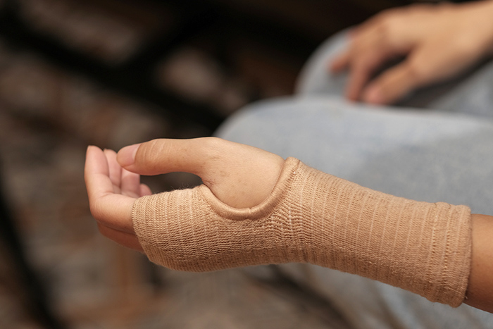 La manga de compresión te ayuda a tratar el linfedema en brazos y manos